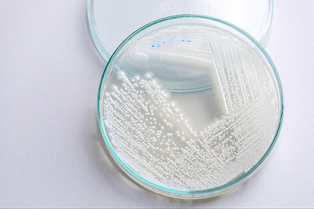 代表 的な産膜酵母ピキア属。白い膜を作る特徴がある。