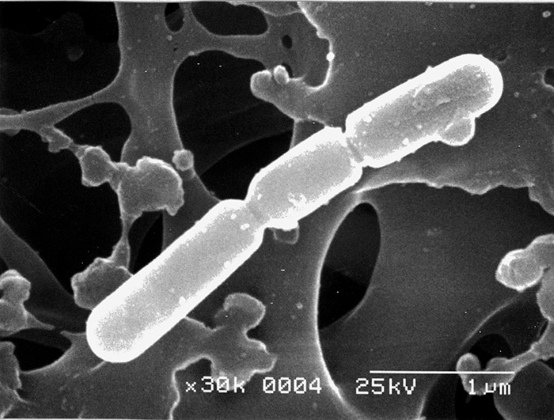 火落菌桿菌（画像引用：灘の酒用語集・灘酒研究会）